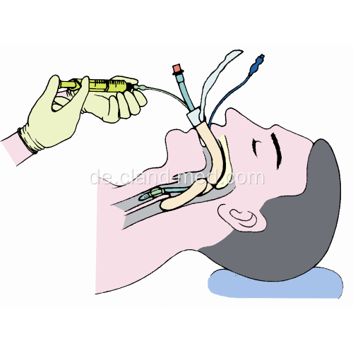 Medizinisches steriles Tracheostomie-Wegwerfset CER genehmigt